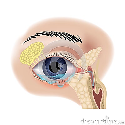 Teary inflamed eye. Blockage of the lacrimal sac or ducts. Vector Illustration